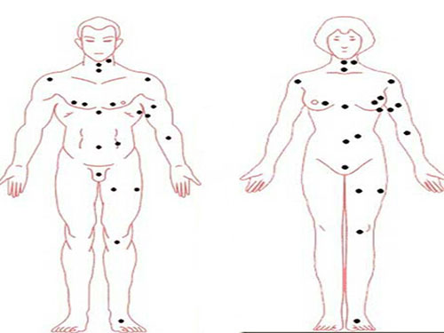 身体上的痣相密码:人体痣相面面观(一)